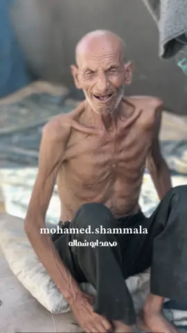 This old man is suffering from malnutrition due to the famine in Gaza and wishes for death. He lives in a displaced and homeless tent. 😓💔#مبادرة_صندوق_الخير #محمد_ابوشماله #صندوق_الخير #محمد_ابوشمالة #ابو_الرجاء #mohamed_shammala #explore #اكسبلور 
