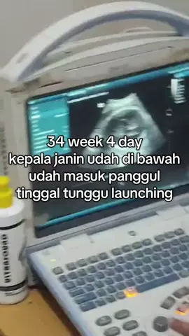 hpl 10 september, kayanya fix lahir agustus deh 🙇‍♀️ #kehamilan #babygirl #usg #34weekspregnant #fyp 