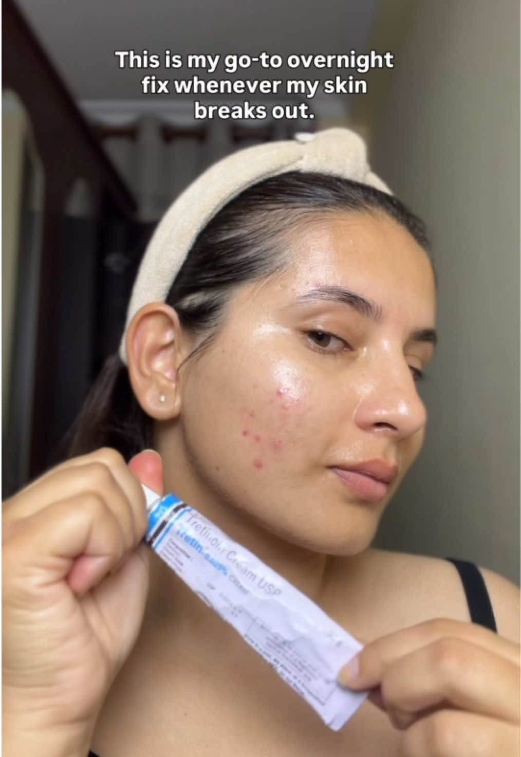 The acne song 👀 This is my little overnight acne hack that actually works for me! Whenever I feel a painful zit coming or my skin’s acting up, I go in with a thin layer of Tretinoin 0.025%, and then seal it with La Roche-Posay Cicaplast Baume B5+ on top. It kind of acts like a pimple patch—calms the area, reduces inflammation, and helps the breakout shrink by morning. It’s simple but super effective. Especially helpful for those deep, painful zits (you know the ones 👀). Try this combo if you’re struggling with cystic or hormonal breakouts—it might just be the game-changer you need. If you already do this or have your own version of an overnight fix, drop it in the comments. Would love to know what works for you too! #SkincareHack #TretinoinTips #OvernightAcneFix #SkinCareThatWorks #RealSkinCare #AcneTips #LaRochePosay #PimplePatchHack #SkincareCommunity #AcneProneSkin #SkincareThatWorks #SkinVibeCheck @La Roche-Posay 