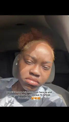 product on sale rn RUN don’t WALK !! #fypシ #tumericsoap #productsoftiktok #naturalbeauty #tumericsoap 