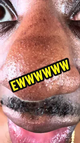 I was so confused. #drmelaxin #exfoliante 