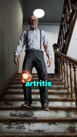 La receta natural que alivia el dolor de artritis, artrosis y hernias #DolorArticular #Artritis #Artrosis #RemediosNaturales #Bienestar #Saludnatural #RemedioCasero #SaludYBienestar 