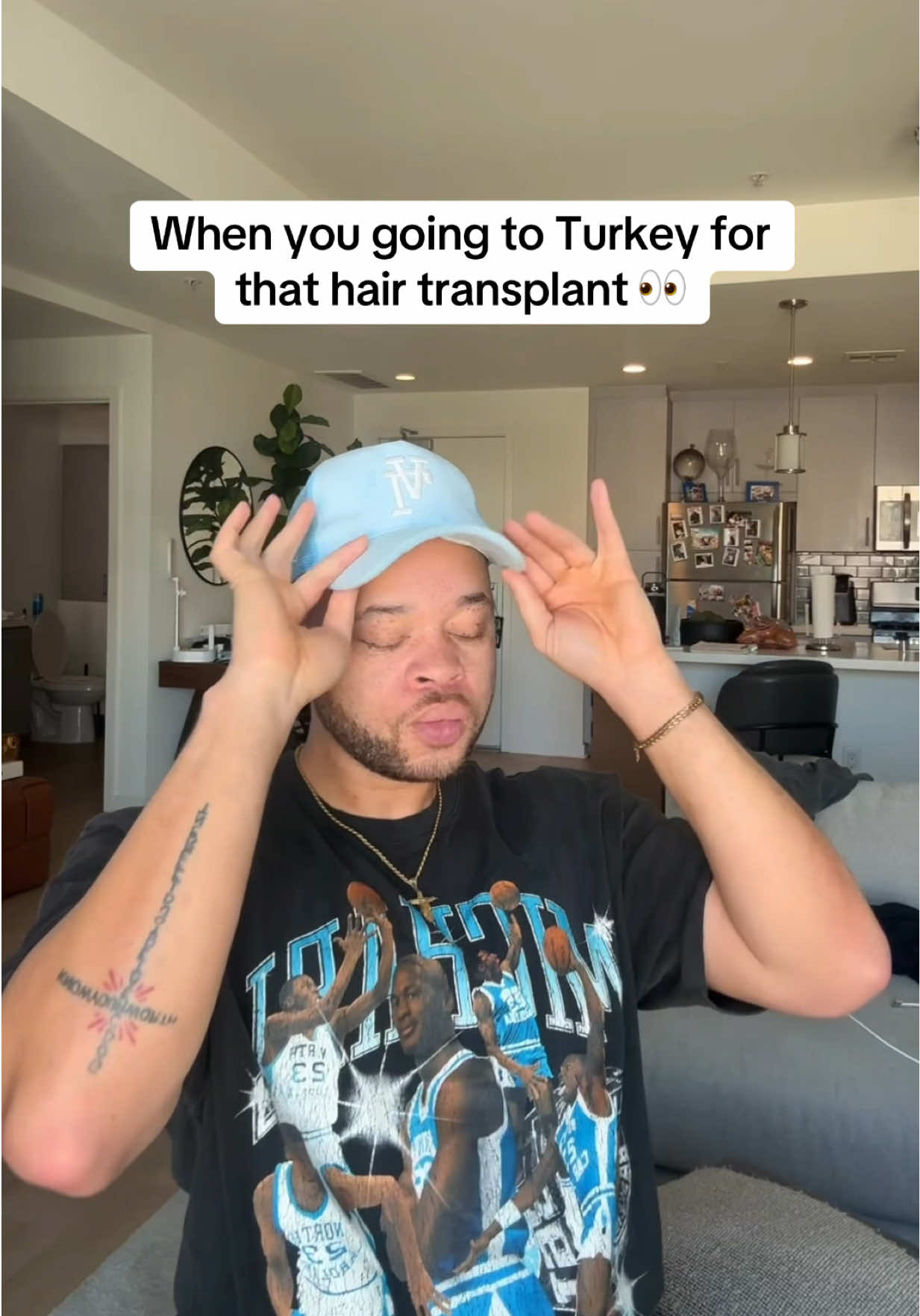 Hair transplant loading……..  #tiktokpartner #BlackTikTok #johnjonne #trending #viral #hairtransplant 