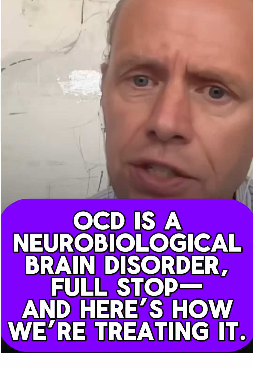 🚨 OCD is a neurobiological BRAIN disorder, FULL stop--and here's how we're treating it. 👏🏾 🧠 EVERYTHING YOU NEED TO KNOW ABOUT DBS & TMS: Precision Targeting, Biotypes, & the Brain Basis of OCD & Depression with Dr. Martijn Figee 🎯 Ep. 48 of A Chat with Uma is out now!🌟 On ep. 48, I sit down with psychiatrist–neuroscientist Dr. Martijn Figee—a groundbreaking pioneer in neurostimulation (e.g. DBS, TMS) for psychiatric disorders, especially OCD & depression—for a clear, grounded tour of circuit‑based psychiatry, explaining how & why the brain can change (in minutes!) when the right circuit is engaged. We unpack deep brain stimulation (DBS) surgery & transcranial magnetic stimulation (TMS), what “target selection” actually means, & how phenotyping (motor, cognitive, & negative‑affect circuits) guides targeting. We discuss access & eligibility, what insurers & clinicians look for, when to choose TMS first, & how accelerated TMS paired with ERP can fast‑track change. We bust myths about the neurobiology & brain basis of mental illnesses & share biotyping work designed to match people to the right target. This episode shares everything you need to know about DBS & TMS from *the* world's expert! Topics discussed include👇🏾 🎯Who is the Martijn behind the titles, really? 🎯From Amsterdam to DBS: imaging arrives, early OCD DBS cases, & changes in minutes 🎯Circuit basics: motor–cognitive–limbic loops across OCD, Tourette, depression 🎯Comorbidity vs. one driver: how untreated OCD breeds depression—& why it changes the treatment plan 🎯Phenotyping (negative affect vs compulsion/motor vs cognitive) to pick a target 🎯TMS before DBS? Standard vs accelerated TMS & pairing every session with ERP; access & insurance 🎯DBS candidacy & access 🎯Targeting, not guessing: ALIC/internal capsule, STN, BNST & fiber‑map guidance pushing outcomes toward ~80% 🎯Biotyping with in-scan tasks: motor/cognitive/limbic dominance; what scans can (& can’t) diagnose—yet 🎯Myth‑busting: OCD ≠ an “amygdala disorder” ☀️ Subscribe, rate, review, & SHARE to support the show 🫶🏾 🔗 Link in bio, or search ‘A Chat with Uma’ on all platforms to listen! #OCD #MentalHealth #mentalillness #dbs #biology #psychology #psychiatry 
