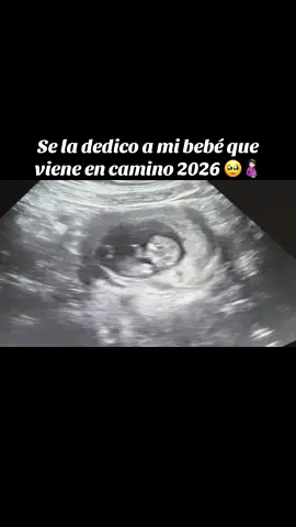 Mi bebé 🤍🥹#fypシ #viral #segundoembarazo 