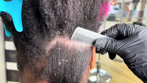 Longer videos will be posted once we hit 10k Follow for more!!  ASMR dandruff scratch