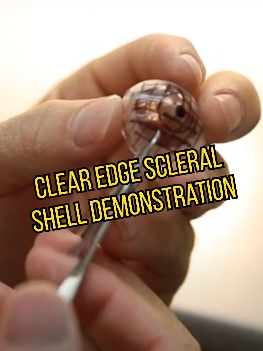Behind the scenes: How Board Certified Ocularist Eric Lindsey builds a prosthetic scleral shell by hand — the craft is real. 🌐 https://www.prostheticartists.com/ 📲 Follow us: Instagram: https://www.instagram.com/prostheticartists/ YouTube: https://www.youtube.com/@ericlindseyprostheticartis3920 Facebook: https://web.facebook.com/prostheticartistsinc #behindthescene #medicalartist #ocularist #scleralshell #FYP #prostheticeye #prostheticartist