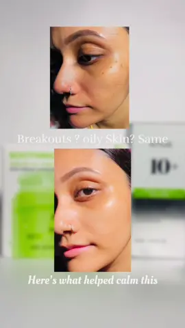 Say hello to calm, clear, and confident skin with Anua Azelaic Serum + Pad! This powerful duo is a game-changer for anyone struggling with redness, uneven tone, or breakouts. The gentle Azelaic Acid in the serum soothes inflammation and brightens dull skin, while the pre-soaked pads exfoliate gently-leaving your skin soft, refreshed, and glow-ready. No harshness. No stickiness. Just pure skin love. Whether you're battling acne or post-inflammatory marks, this combo is here to restore your skin barrier and boost radiance, effortlessly. Use it daily after cleansing for the ultimate glass-skin glow. Sensitive skin friendly | Non-comedogenic | Fragrance- free Anua Azelaic Acid 10+ Hyaluron Serum Anua Azelaic Acid 10+ Hyaluron Pad Main Effects: - Soothe Redness, Rosacea - Soothe Acne, Troubled skin - Fade Darkspots / Hyperpigmentation Ingredients: - 10% Azelaic Acid: Soothes inflamed skin and redness - 3 Types of Hyaluronic Acid: Hydrates and moisturizes skin - Niacinamide & Zinc: Helps balance sebum and oil production - Panthenol & Ceramide: Soothes skin and protects skin barrier @anua_global  . . .  #anua #ultasephora #azelaicacid #acne #oilcontrol #cleangirl #oilyskin #summeracne #enlargedpores #greasyskin #cloggedpores #acneroutine #hormonalacn #acnetreatment #skinbalance #cleangirlskincare #acnesolutions #porecare #acnejourney #kbeauty #viral #sephora 