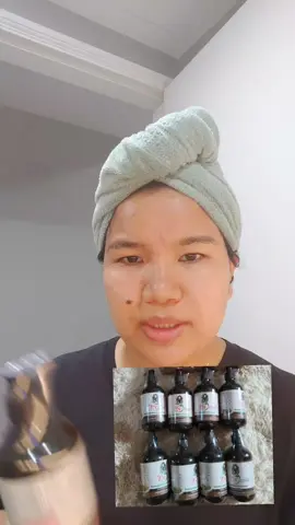 အမြန်လာထားမယ်နော်  #ENEခေါင်းလျှော်ရည်  #သဘာဝနတ်ဆေး  #စင်္ကာပူကိုယ်စလှယ် 