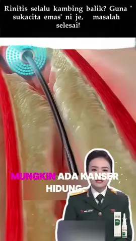 Kering dan rasa tersumbat mulai hilang perlahan-lahan, setiap nafas menjadi lancar dan ringan.🤗#nasaspray #sprayhidung #rendung #selsema 
