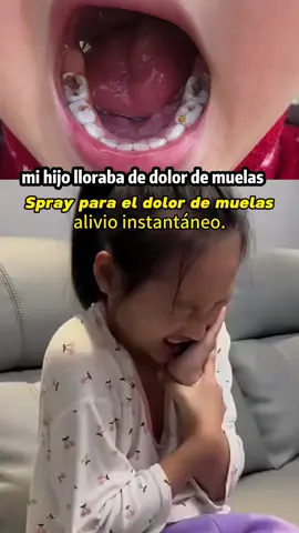 BudgetFriendlyFix #toothache #periodontitis #oralspray #viral #fyppppppppppppppppppppppp 
