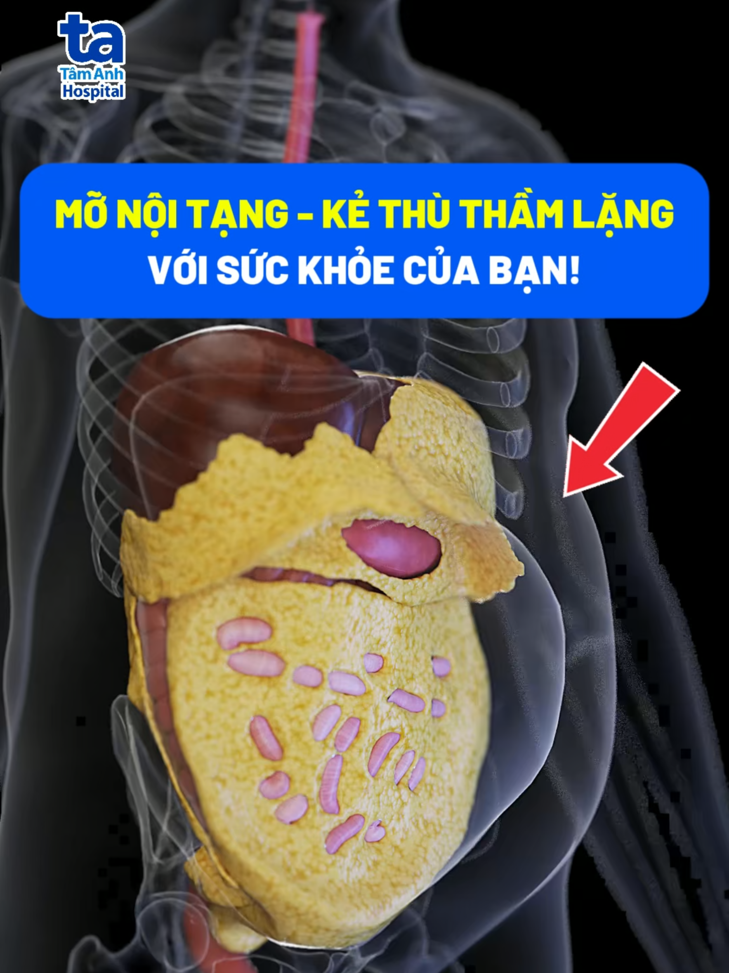Làm sao biết cơ thể đang thừa mỡ nội tạng? #giamcanantoan #healthy #monoitang #songkhoe247 #TiktokForHealth #benhvientamanh #YteCongnghecao
