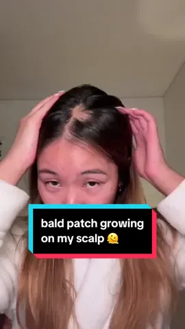 help what do i do 🫠 #baldspot 