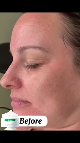 Wrinkles Remover>> #fyp #affiliatemarketing #affiliate #affordable #tiktokfinds 