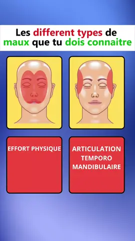CES TYPES DE MAUX DE TÊTE RÉVÈLENT CE QUI SE PASSE DANS TON CERVEAU ! (Le #3 Peut Cacher un DANGRE) 🧠💥   #Migraine #MalDeTête #SantéCérébrale #DouleurChronique #TikTokSanté #ConseilSanté #PremiersSecours #NeuroScience
