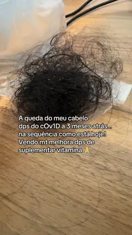 Nem dá pra acreditar! Só quem passa por isso sabe! Vc tbm tá sentindo o cabelo desprendendo da cabeça? 😭#efluviotelogeno #alopecia 