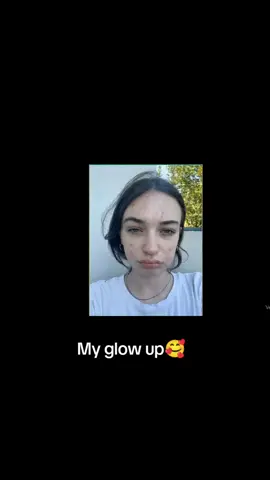 I didn’t get surgery… but it sure looks like I did 💄✨Simulation so real it’s scary 😳 #PlasticSurgerySim #FacialGlowUp #BeforeAndAfter #Rhinoplasty #BeautyTok #FillerSimulation #CosmeticTok #AIBeauty