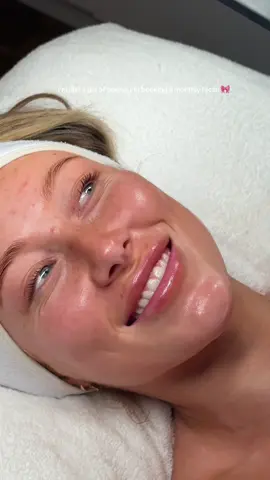 POV: you started romanticising your life 🤍 #fyp #viral #skincare #facial #hydratedskin #skincaretips #clearskin #estheticianlife #model #esthetician #sydney #imjustagirl 