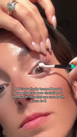 have a chalazion? 👀 #eyecare #styes #chalazion #eyecaretip 