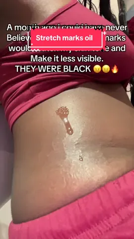 Runnnn 🏃‍♀️💨💨 grab 2 #snatched #stretchmarks #tiktokmademebuyit #spotlight #oil #invisible 