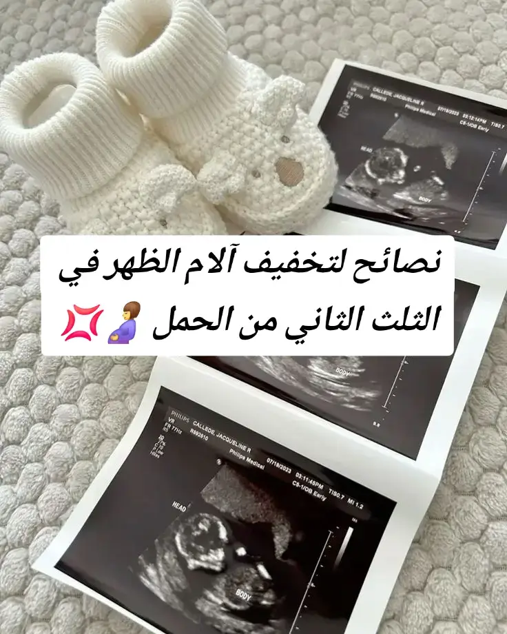 > ظهرك يوجعك في الحمل؟ 😣 خاصة في الثلث الثاني؟ جربي هالنصائح البسيطة تخفف عنك التعب وتريحك 💆‍♀️ لأنك تستحقين الراحة والاهتمام 🤍 #آلام_الظهر #الحمل_الثلث_الثاني #نصائح_للحامل #ماما_قوية #حمل_صحي #حامل_وأفتخر #تجربتي_في_الحمل #حياة_الحامل