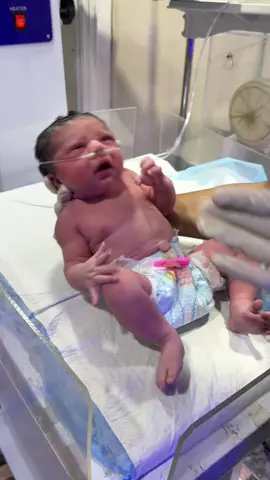 Newborn Baby Moro relfex 😱😱😳#viral #newborn #babycare #fisrtcry #care #nicucare #justborn 
