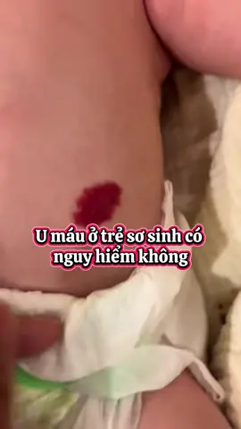 U máu có nguy hiểm không? #tapxaykenhtiktok #thôngtiasữa #thongtiasuahanoi #kichsua #embedangyeu 