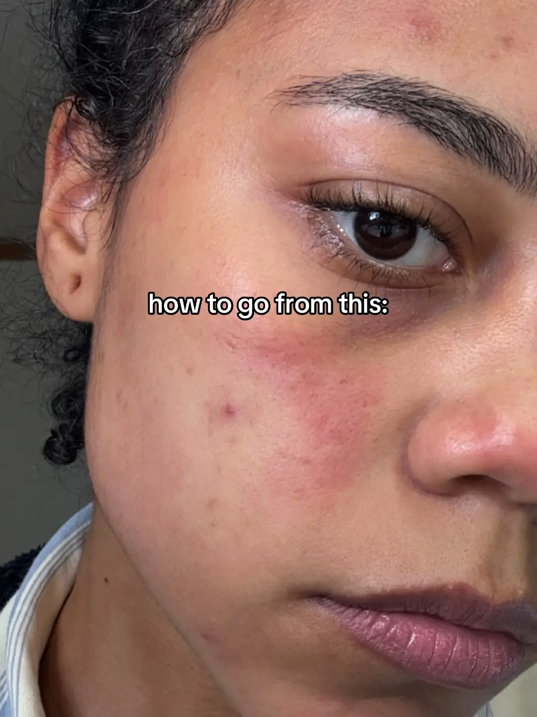 i might just be addicted to it... thank you skintok for introducing me to this godsend of a product. why is it so underrated 😭 #sensitiveskin #porecare #ricemochicleanser #acneproneskin #arencia @Arencia 