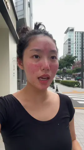 24 hour challenge..let’s go.. Thank you @bano.global 😭 #banobagipartner #skincare #skincareroutine #koreanskincare #acnetreatment #skincaretips  #bano #banocosmetic #kbeauty #skincare #banomilkthistle  #milkthistleserum #milkthistlemask  