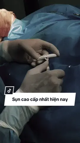 Mỗi lần gọt bằng 50củ của các bạn #xuhuong #muitrunghoa #nangmui #surgiform #muicautruc 