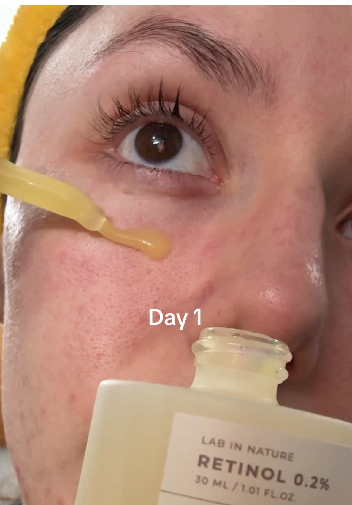 Madagascar Centella Retinol 0.2 Boosting Shot Ampoule #spicule #spiculeampoule #centella #centellaskincare #skincare #skin1004 #koreanskincare #ampoule #serum #skincareroutine #skincareproducts #labinnature #retinol #skin1004retinol  @SKIN1004 US #skin1004 #centella #TikTokMadeMeBuyIt #koreanskincare #kbeauty #skincareroutine #GoViralWithSKIN1004Challenge 