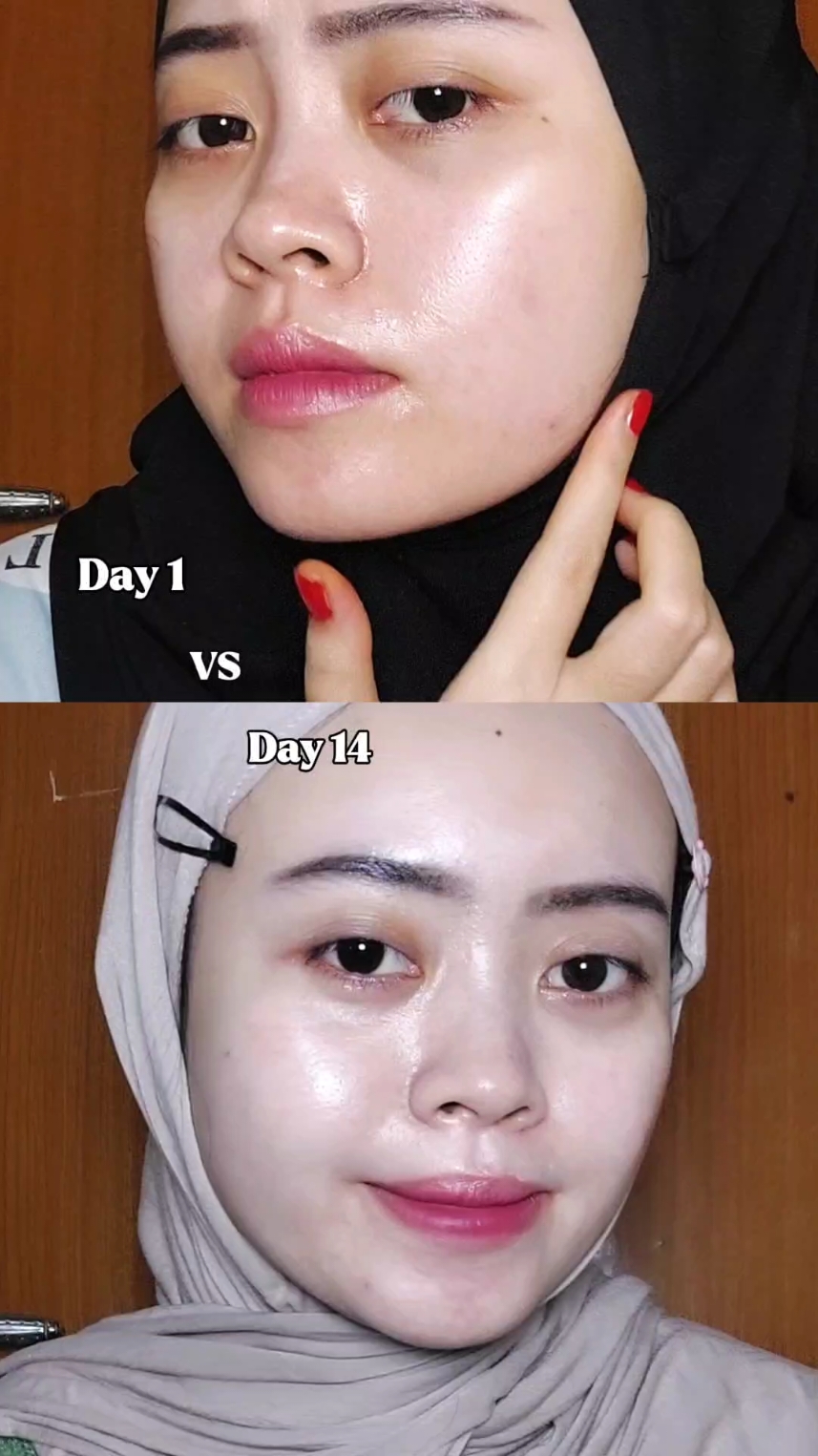 Nyesel baru cobain skincare ini sekarang, kenapa ga dari dulu coba🫵🏻😭 @keziabeautyofficial  #KeziaSkincare #SemuaBisaGlowing #Kezia #KeziaWhiteningSeries #SkincareRoutine 