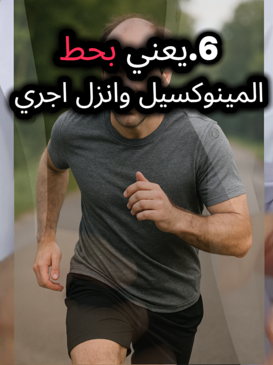 ٦ أخطاء شائعه في استخدام مينوكسيديل؟ #صلع #افوجين للحواجد #صلع_وراثي #قاهري_الصلع_الوراثي  #eslamelghopary 