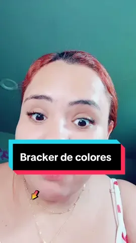 #Dental #Fashion #colorful #Braces #Brackets #brackets #bracescolors #with #forwomen #tiktokshop 