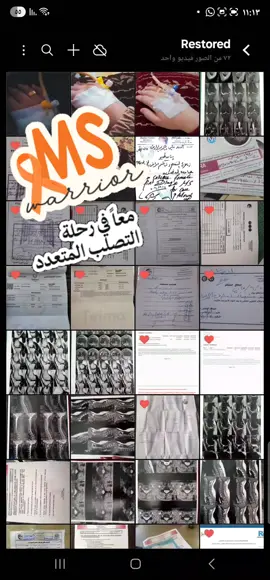 الجانب المظلم من حياة مريض التصلب المتعدد👌 #التصلب_اللويحي_المتعدد_ms🎗  #محاربة_التصلب_المتعدد_ms  #الامراض_المناعيه 