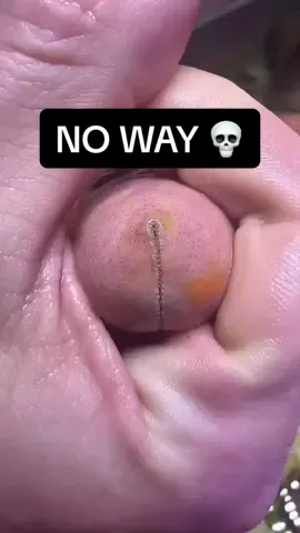 I was NOT ready for that 😳💀   #fyp #wtf #funnyvideos #relatable #comedy #waitforit #viralvideo