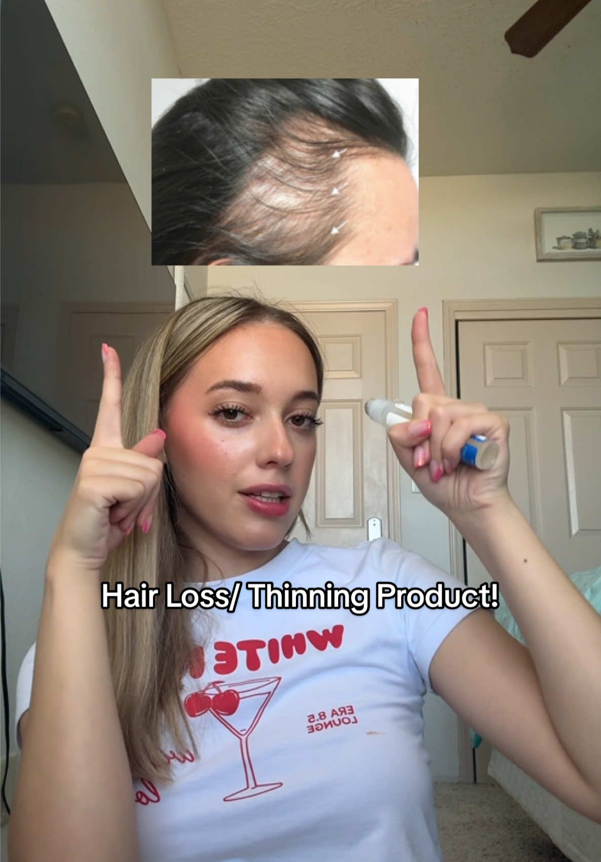 Been using this hair regrowth roll-on for thinning spots — it’s easy to apply and doesn’t leave any residue.  #creatorsearchinsights #HairRegrowth #HairLossHelp #RollOnSerum #ThinningHair #HairGrowthJourney #TikTokShopFinds   