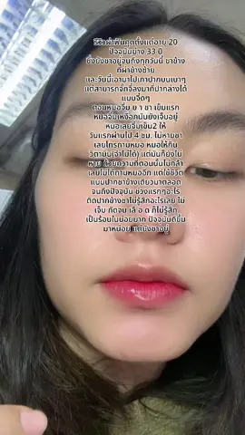 รีวิวผ่าฟันคุดที่ชายาวนานที่สุดในชีวิต #ผ่าฟันคุด 