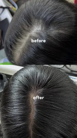 my secret!🫵🏻 #labonhair #growthstartshere 