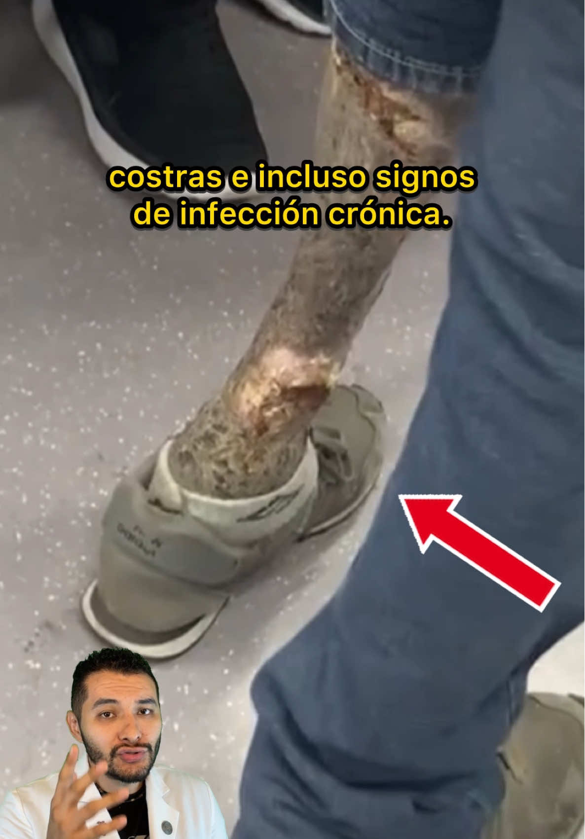 Esto NO es una prótesis 😳😱 #pontecrimi #AprendeEnTikTok #EduTok 