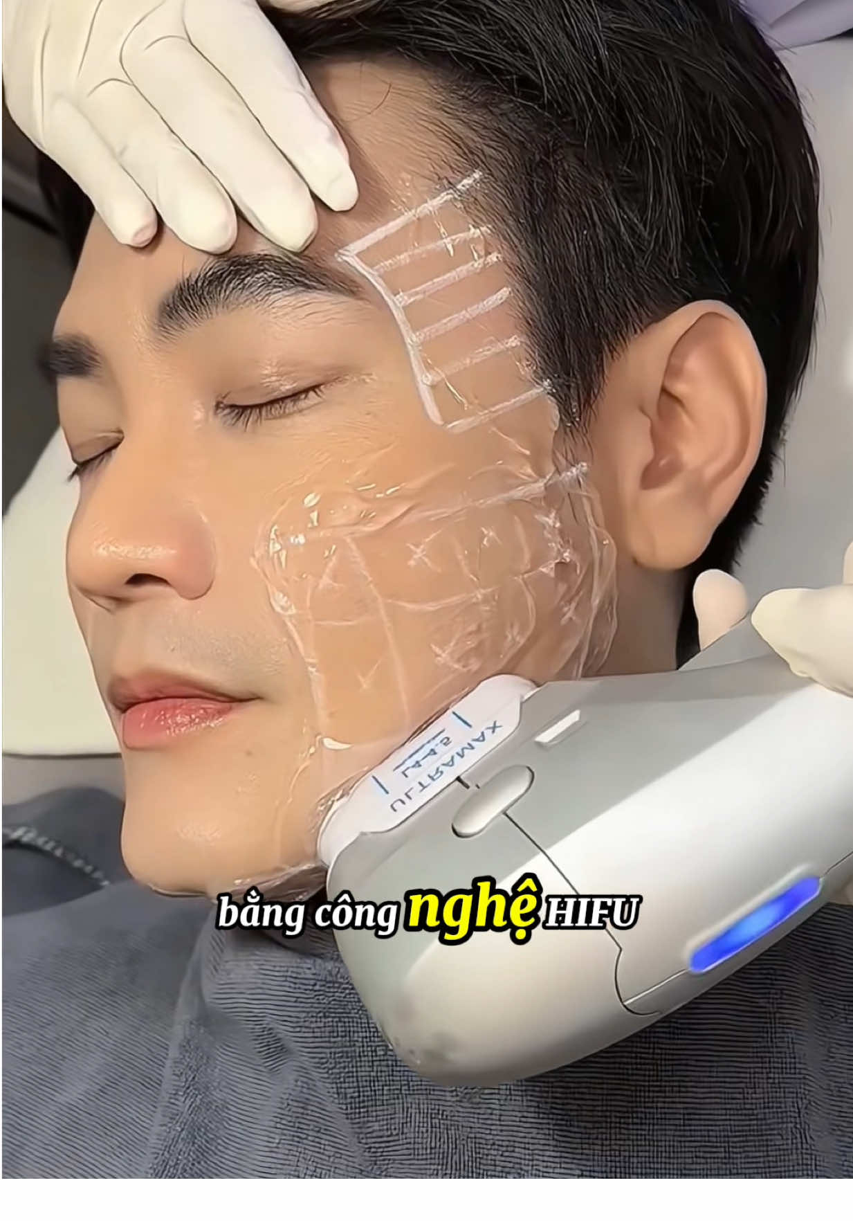 Hỏi sao dạo này mặt gọn, da căng? 👉 Bí kíp nằm ở một buổi #HIFU thôi đó  😎Không xâm lấn – không nghỉ dưỡng – hiệu quả rõ rệt #hifu #nângcơ #spaformen #skincare 