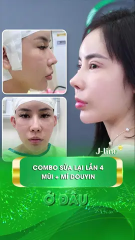 Sửa 3 lần đều hỏng, lần thứ 4 đến J-Line muốn theo trend tỷ tỷ Douyin. #jlinekorea #nangmuidouyin #muigotrunghoa #phauthuatthammy #mitrunghoa #nhannhantrung #nangmuitrunghoa #xuhuong 