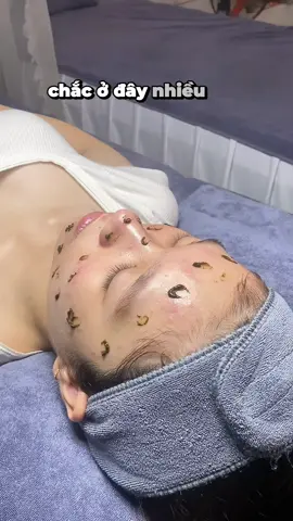 #laynhanmun #laynhanmunchuanykhoa #nanmun #nanmunbangtay #spaquan12 #spauytin #xuhuong #tiktok #xh #viral 