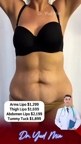 Let's compare the changes before and after liposuction combined with tummy tuck with Dr. Yud Min • Liposuction is a method of removing excess fat from the abdomen by using a small suction tube (cannula) to suck the fat out of the body. Suitable for people with firm skin, but localized fat accumulation.  • Tummy tuck surgery aims to remove loose skin and excess fat, and can tighten stretched abdominal muscles (especially after childbirth or significant weight loss). It is often combined with liposuction to achieve the best and most beautiful results. #tiktokaustralia #liposuction #tummytuck #plasticsurgery #tiktokaustralia🇦🇺 #beforeandafter 