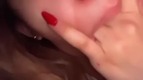 ##