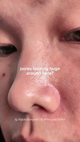 T-zone problems? Aku sering banget ngerasa area sini tuh oily & full of clogged pores. So I gave Becoming Purifying Clay Mask a try — and the result? Clean, calm, and refreshed skin ✨ Only 10–15 minutes needed. So simple. ➤ Wajib dicoba buat yang kulitnya gampang kusam di area T-zone. @becoming Indonesia  #PoreReset #claymask #skincareroutine #unclogedpores #becomingbesties 