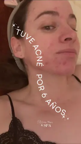 📲 ¿Lista para empezar tu transformación? Puedes conseguir tu kit de desintoxicación y los productos DMCEUTICALS directamente en mi tienda de TikTok, en el catálogo de WhatsApp, o agendar tu cita conmigo para una asesoría personalizada. 💬 Escríbeme al +1 414 334 3236 y te ayudo a elegir lo mejor para tu piel. Tu cambio empieza hoy 💛