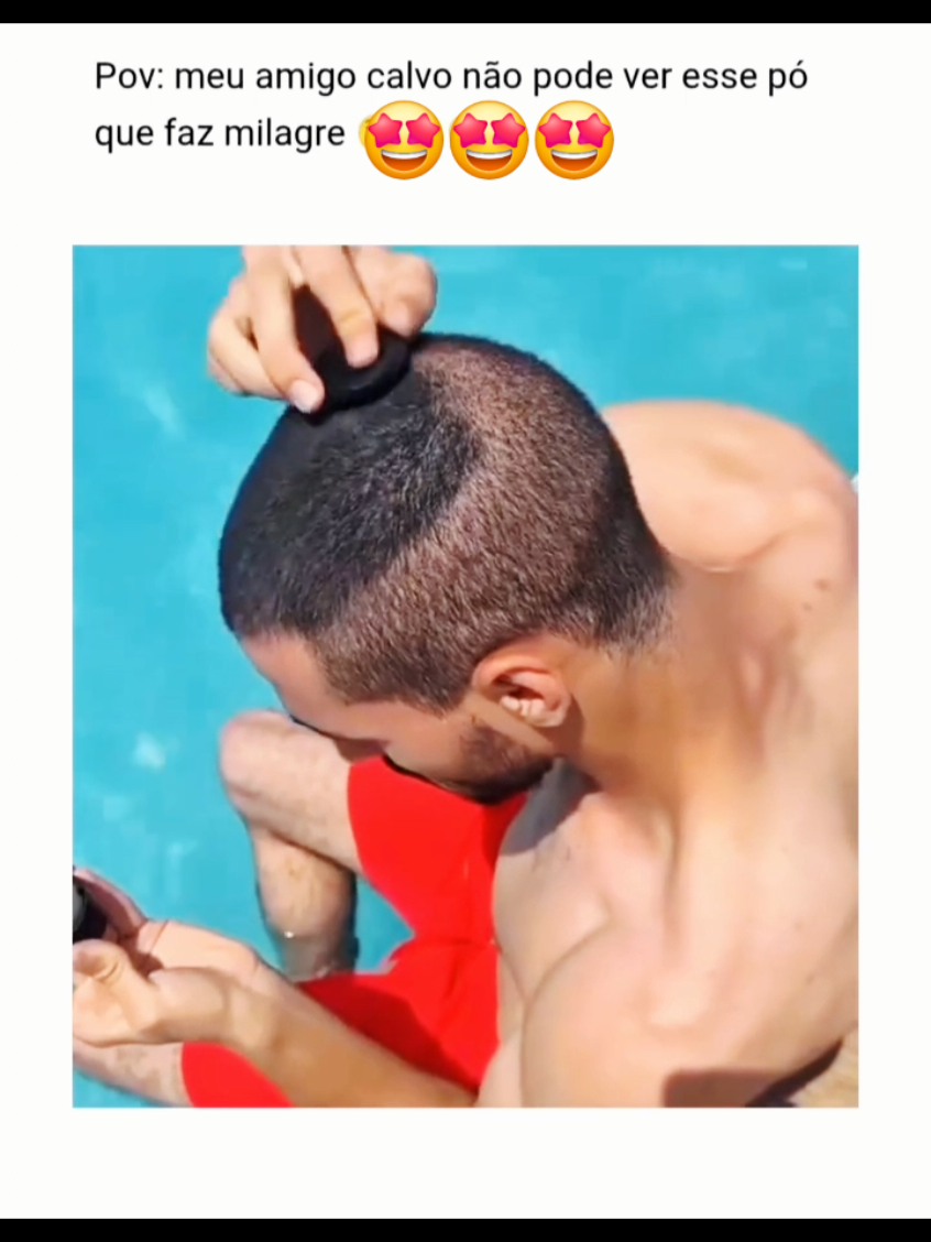 Depois desse po mágico so fica com calvície quem quer... 🤌🤩 #calvície #calviciefeminina #calviciemasculina #calvo #calvos #careca #quedacapilar #maquiagemtiktok #maquiagem #hair #hairtutorial 
