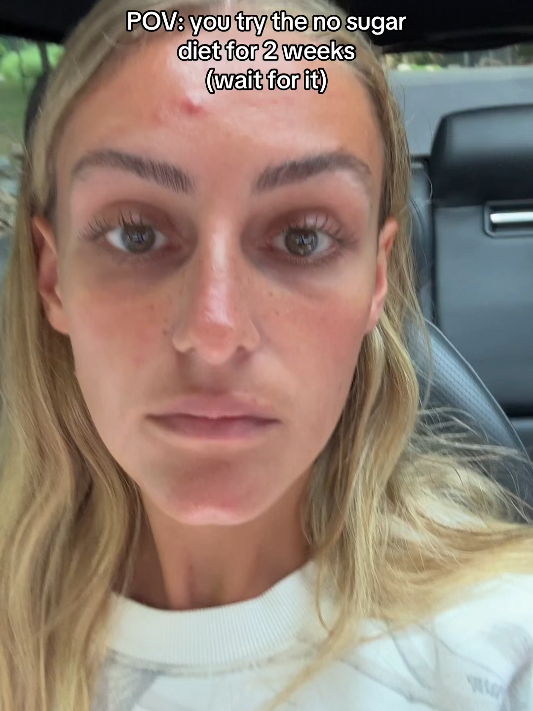 No Sugar Diet Face Transformation Over One Year #BVIRAL