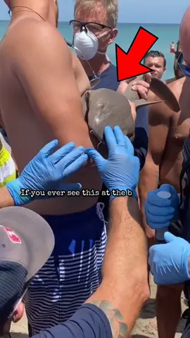 if you ever see this at the beach run 🏃‍♂️ #fyp #ViralVideo #zackdfilms #interestingfacts #facts 